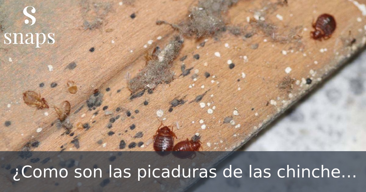 ¿Como son las picaduras de las chinches?