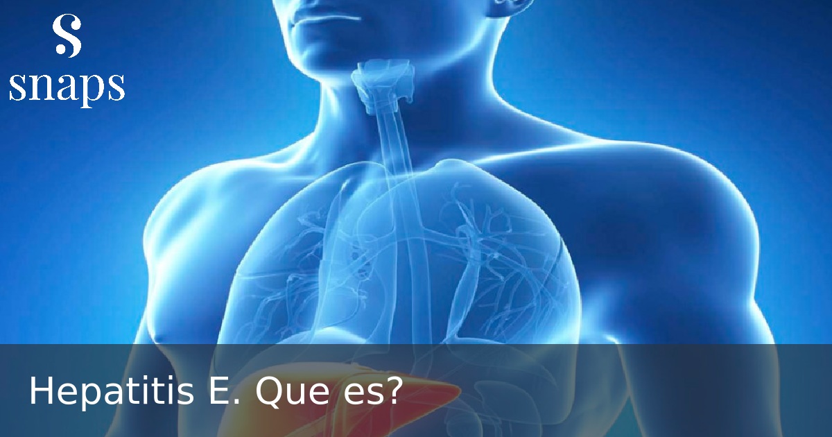 Hepatitis E. Que es?